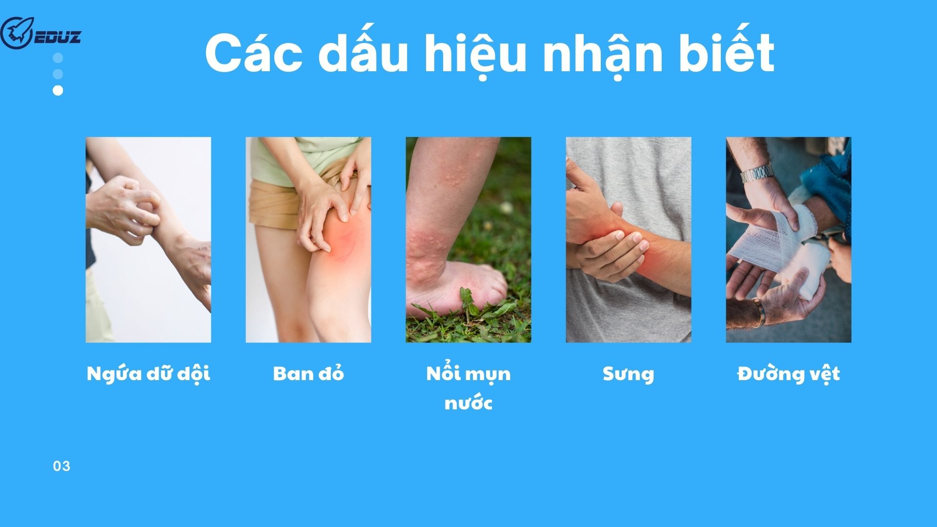 3. Dấu hiệu nhận biết